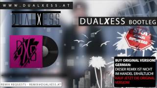 Max Giesinger  80 Millionen DualXess Bootleg [upl. by Niroc]