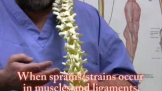 Lower back Pain sports Injuries trauma self treatment [upl. by Trofmoc]