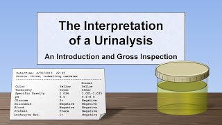 Interpretation of the Urinalysis Part 1  Introduction and Inspection [upl. by Pia]