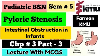 Pyloric Stenosis in URDUHindi  Pediatric Nursing  BSN Sem  5 Unit  3 part3 KMU MCQS Pattern [upl. by Votaw323]