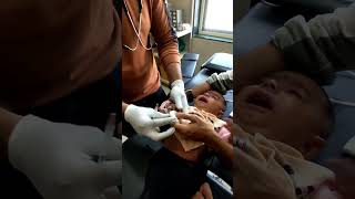 Polydactyly removal procedure by cautery mbbsaiimsdoctor bamsytshortsyoutubeshortsnursing [upl. by Holton]