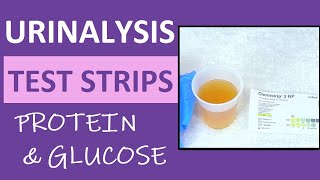 Albumin Detection in Urine  Determination of Albumin in Urine  यूरिन में एल्ब्यूमिन चेक कैसे करें [upl. by Eelidnarb]