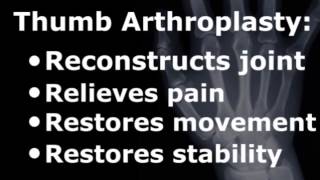 Thumb CMC Arthroplasty  Thumb Joint Reconstruction [upl. by Scotney112]