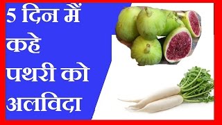 5 दिन मैं कहे पथरी को अलविदा  गुर्दे की पथरी की चमत्कारी दवाई  KIDNEY STONE HOME REMEDIES [upl. by Sivi]