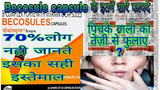 Becosule capsule benifit in Hindi। Becosule capsule ke फायदेनुकसान। [upl. by Noned]