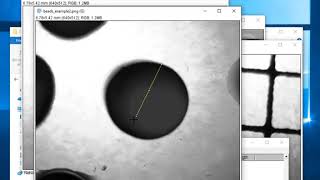 Using ImageJ to measure size [upl. by Lasala427]