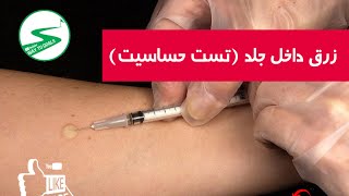 آمپول Intradermal Injection  ID  زرق داخل جلد  تست حسایت [upl. by Yert]