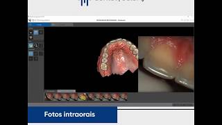 CS 3600  Recursos de Fotos Intraorais em Full HD [upl. by Wahkuna]