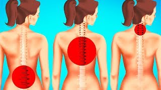 1Minute Exercises to Improve Posture and Reduce Back Pain [upl. by Adnat]