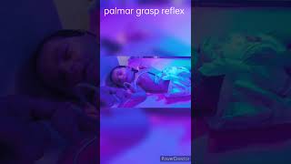 palmar grasp reflex  paedia drhimanshurastogi [upl. by Enileda466]