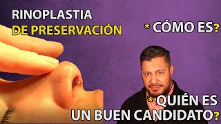 🏹 RINOPLASTIA DE PRESERVACIÓN QUÉ ES CUÁNDO HACERLA 🎯 [upl. by Gnuoy]