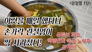 손가락 관절염 천연 치료법 1탄🧅 관절 아플때 통증 치료 류마티스 관절염증 싹 없애는법 찜질하는 법 [upl. by Allenotna]