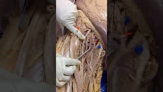 Femoral Artery and Branches dissection of cadaver human anatomy lab 1st MBBS [upl. by Adnale807]