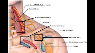 Thoracic Outlet Syndrome TOS vs Cervical Radiculopathy [upl. by Diandre214]