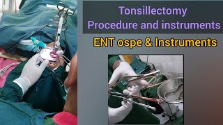 Tonsillectomy Thorat Surgery Instruments  ENT Ospe [upl. by Kahaleel]