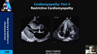 Restrictive Cardiomyopathy [upl. by Yllet]