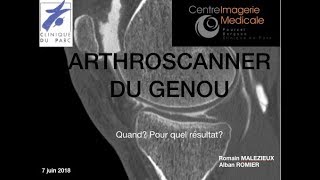 Arthroscanner du genou Alban ROMIER [upl. by Giselle772]