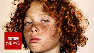 Celebrating freckles in all their glory  BBC News [upl. by Garibold98]