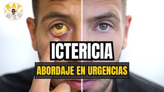 ICTERICIA  ABORDAJE CLÍNICO DE URGENCIAS🚨 [upl. by Fusuy48]