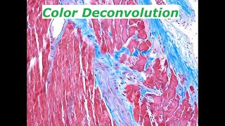 Separating colors in light microscopy images Color Deconvolution in ImageJFIJI [upl. by Airdnas]