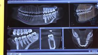 Sirona presenta ORTHOPHOS XG 3D [upl. by Zanze721]