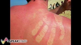 Sonnenallergie – Wenn die Strandferien zur Qual werden [upl. by Favianus]