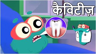 कैविटीज़  दांतों में कीड़े  Cavities In Hindi  DrBinocs Show  Educational Videos For Kids [upl. by Icats]