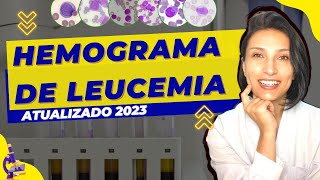 Hemograma Completo de Leucemia  ATUALIZADO 2023  Células Sanguineas  Biologia  Biomedicina [upl. by Amaris897]