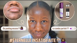 Avoir une belle peau noire sans taches avec la vitamine A  mon bilan 2 mois inattendu [upl. by Ulysses152]