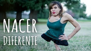 Soy una Mujer Trans nací con Medio Cuerpo y encontré a mi Amor  Nacimos Diferentes  truly español [upl. by Tarrah836]