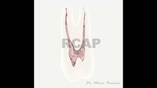 Maxillary First Premolar  Prof MarcoVersiani [upl. by Ilajna]