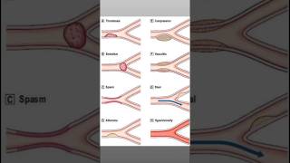 Vascular Pathology vetmed veterinary pathology health [upl. by Rustice506]