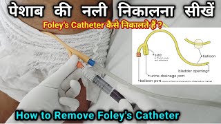 Urinary Catheter Remove कैसे करें  How to remove foleys Catheter  Foleys Catheter कैसे निकाले [upl. by Odradlig510]