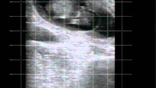 BoviScan Veterinary Ultrasound 48 day bovine pregnancy [upl. by Santoro]