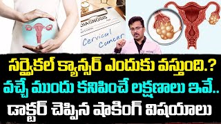 Dr Bharath Kumar About Cervical Cancer Symptoms  Cervical Cancer Signs In Telugu  iDream Health [upl. by Lemra]