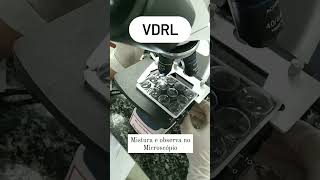 VDRl test technician life shorts video WhatsApp status 🩺🏥🔬💉💝💫🫀🩸medicalstudent71 [upl. by Stevy622]