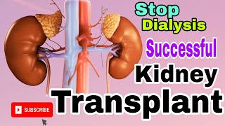 Stop Dialysis  Successful Kidney Transplant Surgery  Aarogyam Superspeciality Hospital 🏥 [upl. by Cornela]