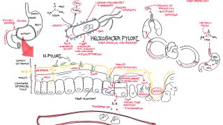 Microbiology  Helicobacter Pylori Ulcer [upl. by Etnohc203]