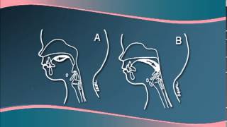 Chapter 3  Understanding Cleft LipPalate Physiology [upl. by Renba]