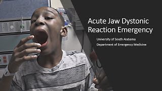 Acute Jaw Dystonic Reaction Emergency [upl. by Jepson]