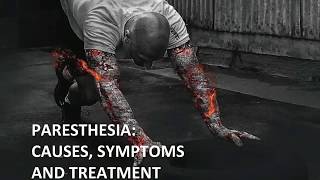 Paresthesia Causes Symptoms and Treatment [upl. by Valida]