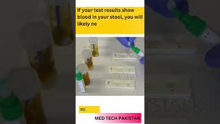 Stool examination  Fecal Occult blood test trendingshorts science amazingfacts youtubeshorts [upl. by Enyamert542]