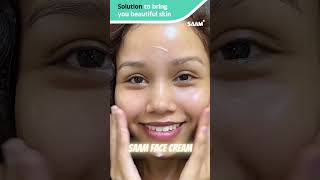 Melasma Solved I Found the BEST Cream for Hyperpigmentation melasma hyperpigmentation facecream [upl. by Akinor]