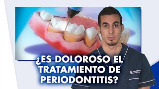 Tratamiento de la PERIODONTITIS  ¿Es doloroso ¿Cuánto vale  Shorts [upl. by Bryn]