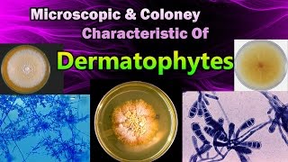 Morphology amp Colony Characteristic Of Dermatophytes [upl. by Roxana]