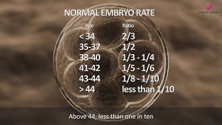 Case Interview  Normal Embryo Rate at Your Age [upl. by Enelrahc]