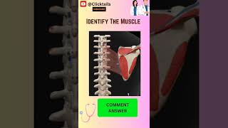 Identify the Muscle of upper limb anatomy neetpgmcq upperlimbanatomy [upl. by Hillary]