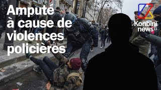 Violences policières  Ivan a été amputé des testicules suite à une manifestation il raconte [upl. by Casey559]