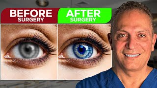 The Incredible BEFORE and AFTER of a Lasik Eye Surgery Real Patient [upl. by Merton]