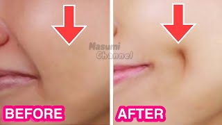 How To Get Dimples Fast amp Naturally Simple Facial Exercises to get Dimples without Surgery [upl. by Joella]